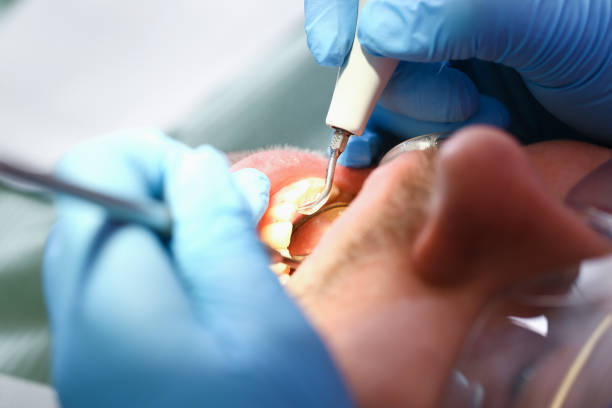 Best Emergency Treatment for Dental Infections or Abscesses in Pageland, SC