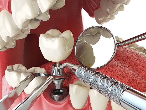 Best Emergency Treatment for Dental Infections or Abscesses in Pageland, SC